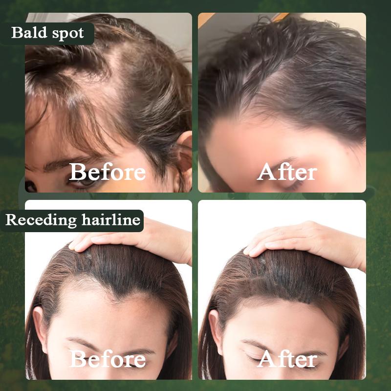 [BAZZAR 2025 Recommnended] Rosemary & Mint Hair Growth Oil